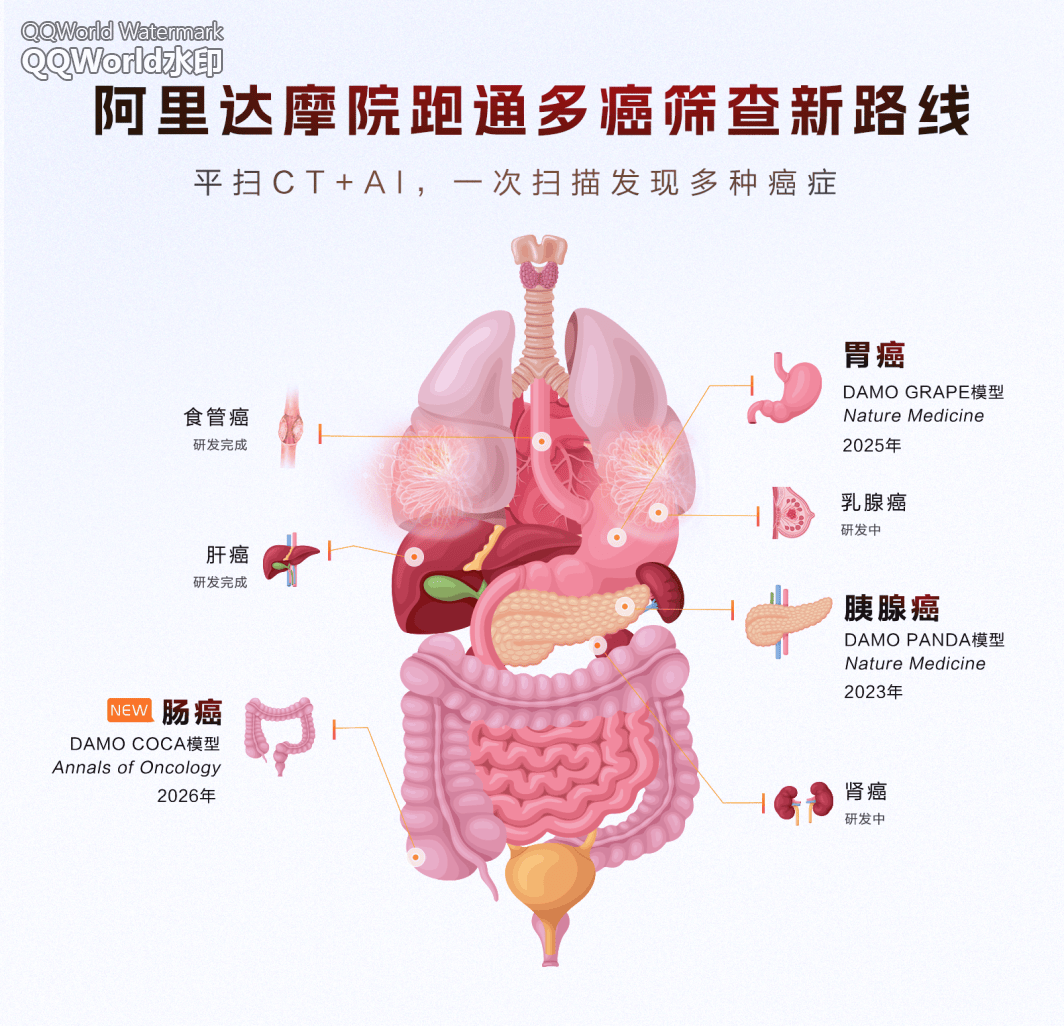 阿里达摩院 AI 全球首次实现肠癌“无感”检测,登上国际肿瘤学顶刊 图片